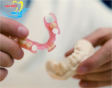 bảng giá trồng răng giả bằng hàm giả tháo lắp phụ thuộc vào chất liệu làm hàm giả