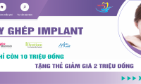 Chương trình khuyến mại cấy ghép Implant lớn nhất năm 2021