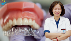 Cùng chuyên gia giải đáp vấn đề niềng răng trong suốt có đau không?