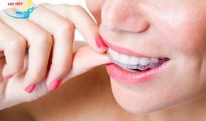 Niềng răng hô không mắc cài – Giải pháp thẩm mỹ răng ưu việt