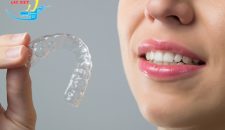 Niềng răng Invisalign có đau không – Chia sẻ kinh nghiệm thực tế